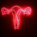 Aborto